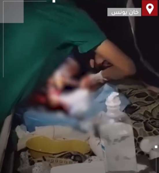 براعة طبيب .. عملية جراحية على ”ضوء الهاتف” في مستشفى ناصر المحاصر!